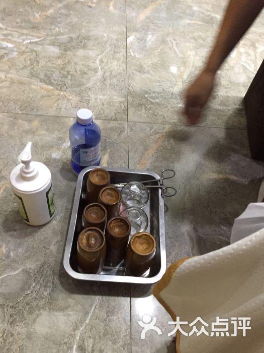 足底拔罐工具