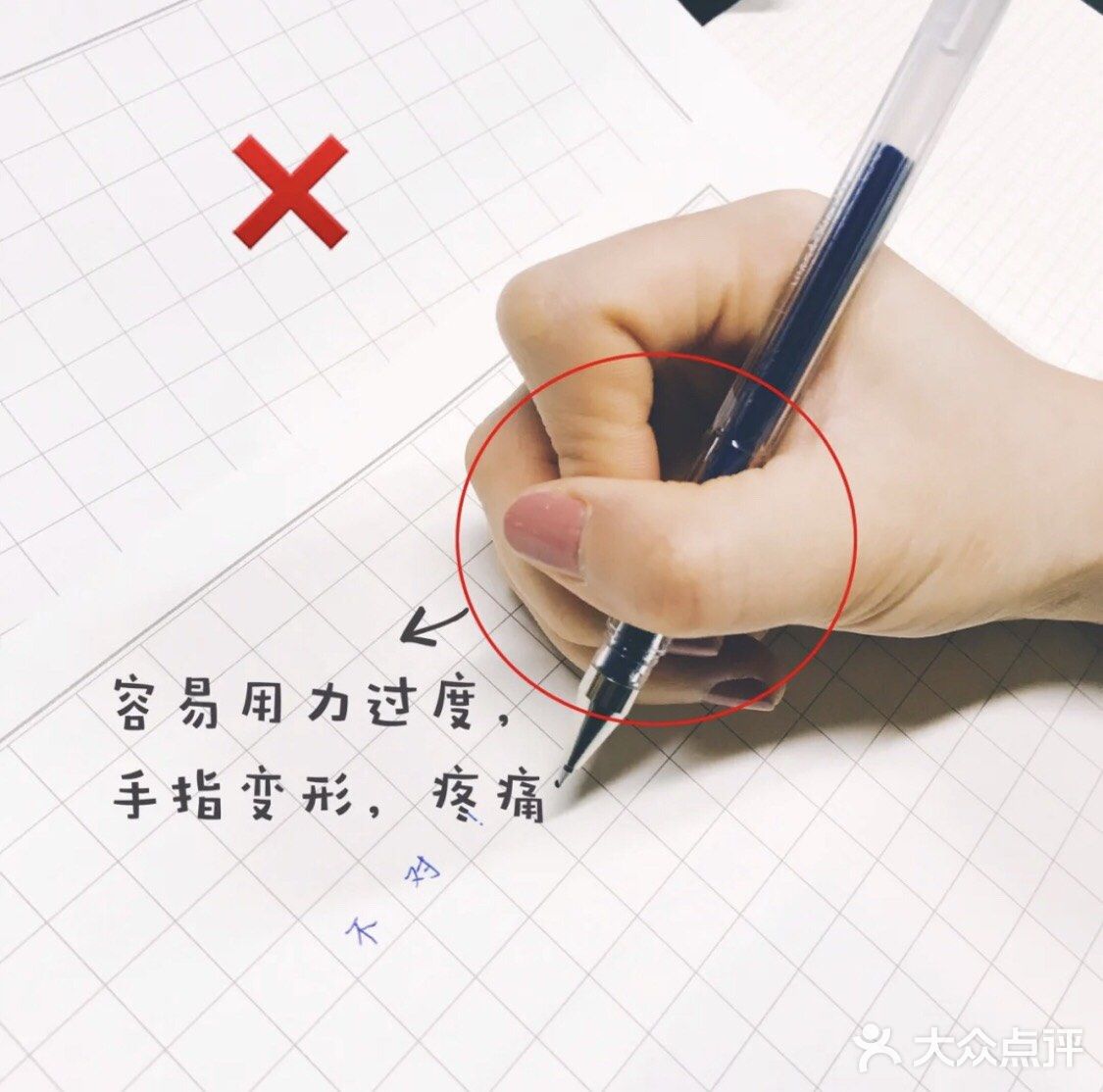 握笔姿势错误居然手指变形解决宝妈们最大苦恼