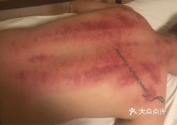 刘超盲人按摩所二店