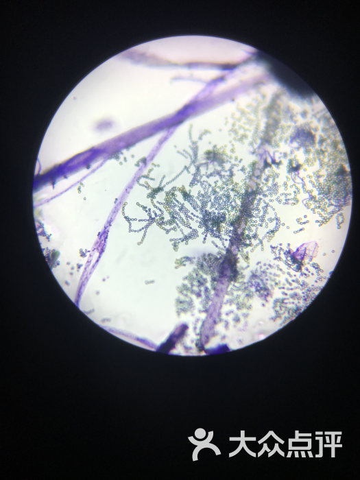 培养出的真菌,显微镜下图像
