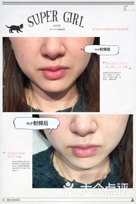 光spa小v脸