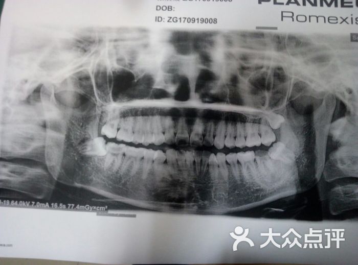 郑伟光口腔门诊部拍片图片 - 第3张