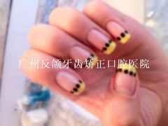 广州反颌牙齿矫正口腔医院