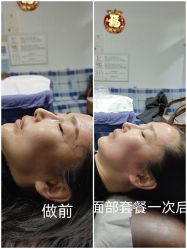 匀畅徒手产后骨盆修复腿型矫正面部骨雕