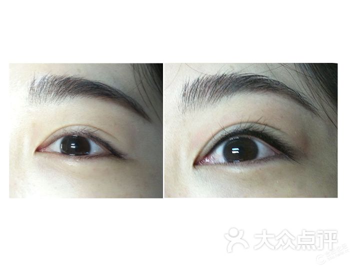 美瞳线前后对比