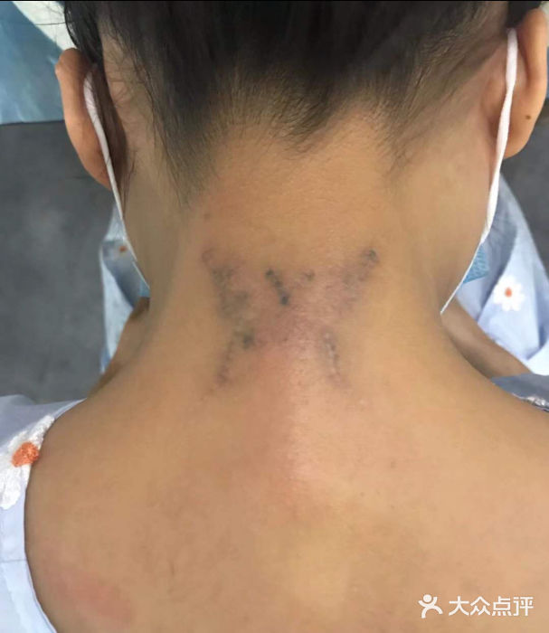 洗博士·超皮秒专业洗眉·洗纹身(港惠店)-图片-惠州