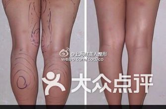整型医院排名_医院图片真实(3)