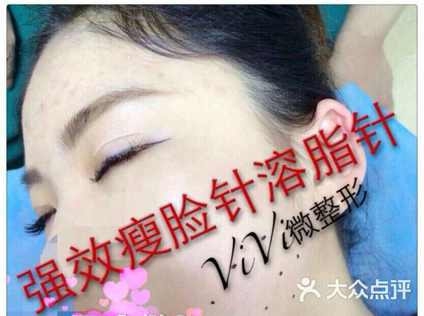 瘦脸溶脂针