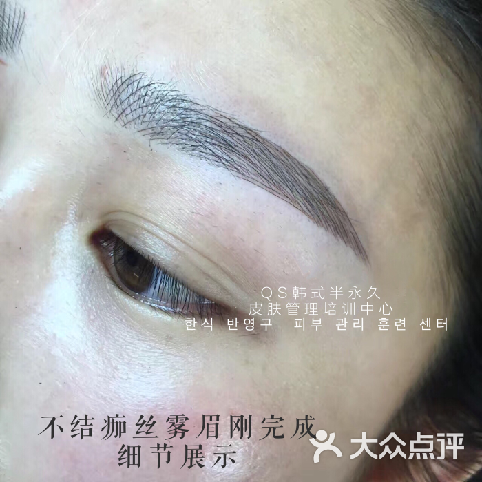不结痂丝雾眉刚完成效果