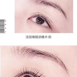 眉睫之什么成语_倒睫是什么样子图片