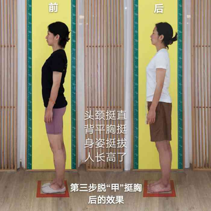 李大连徒手体态矫正