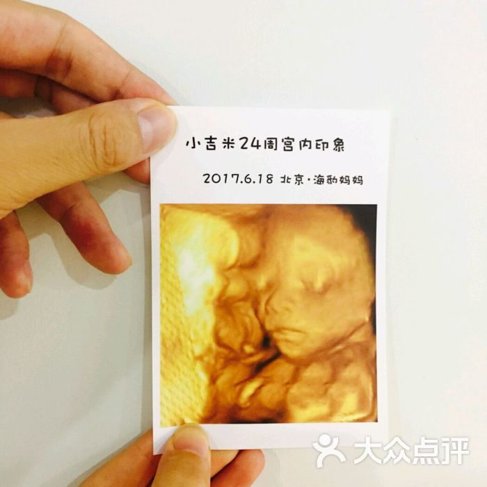 海豹妈妈四维彩超五维彩超