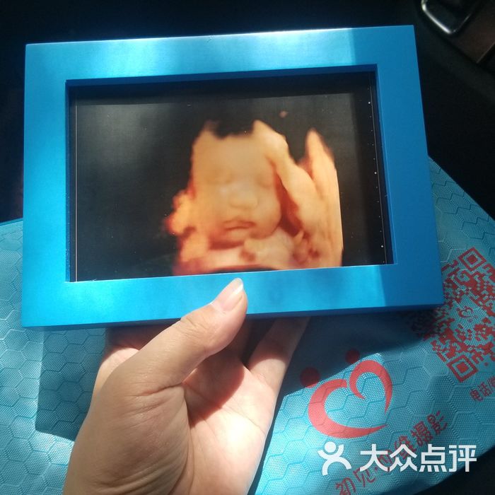 初见四维彩超五维彩超