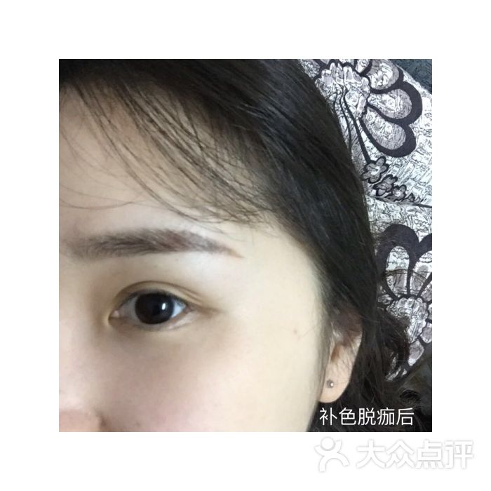 雾眉修复后