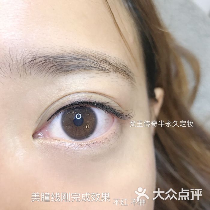 美瞳线刚完成 不红不肿