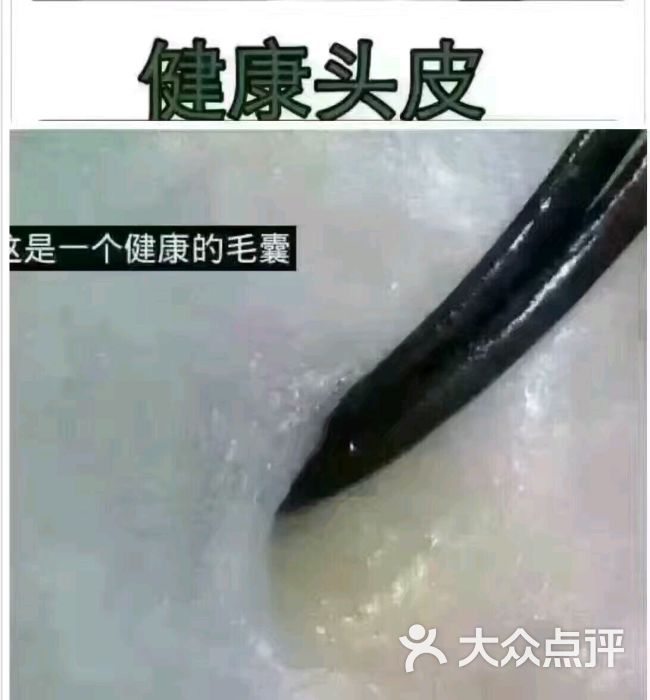头皮