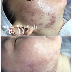 皮肤修复最好的机构 RmhxoMDgRE1oUW0CXPNf2gnqRsTVIJA379kfMncQe4kG_Xsdth6EMZWyFPLxdLHdQs6E6HQccbzhvkqkRN4krQ.jpg