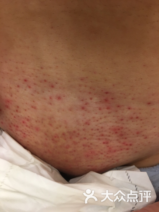 比基尼脱毛在上海做的人家很少,后来了解在高档会所的比基尼一般收费
