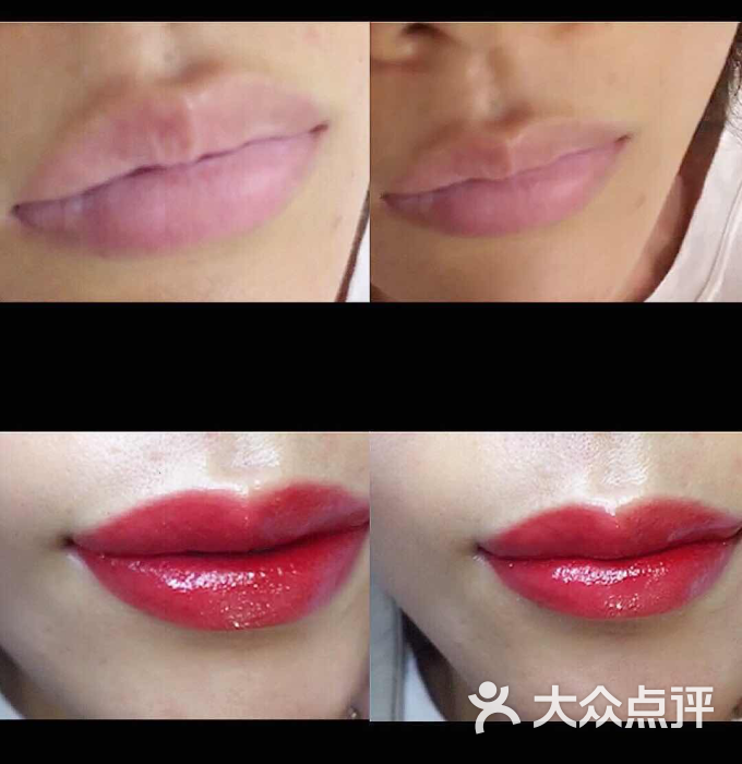洛辰微美汇(韩式皮肤管理半永久)芭比唇前后对比图片 - 第16张