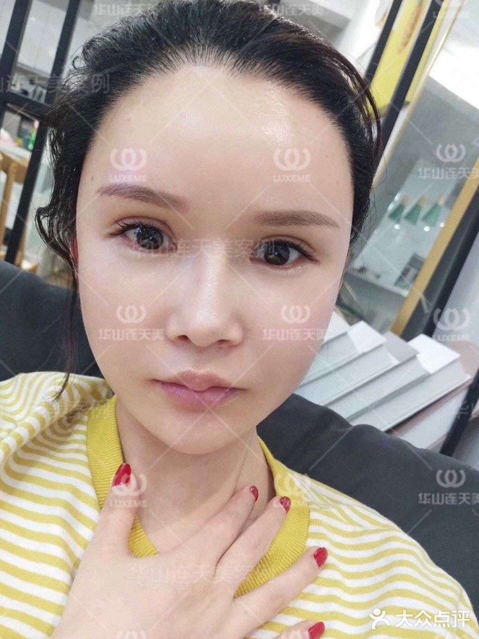 谁告诉你们我不会做咬肌切除的