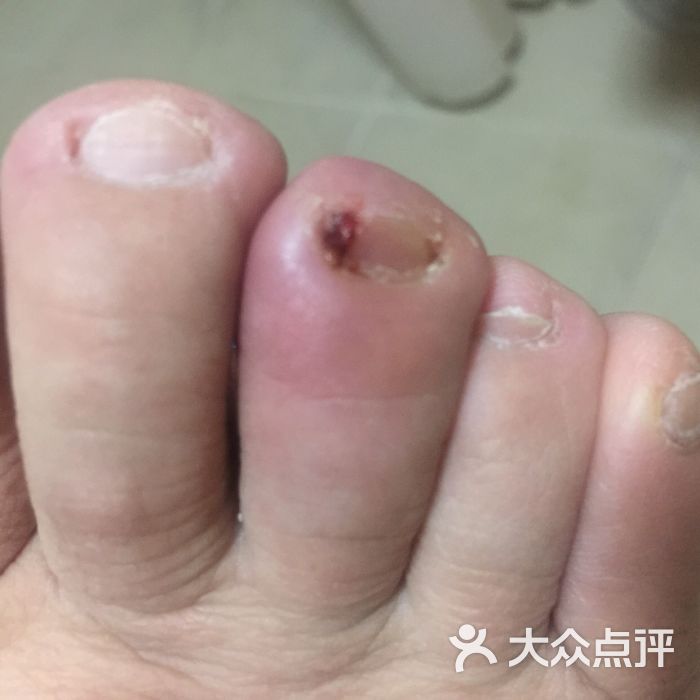 清华池脚病治疗中心