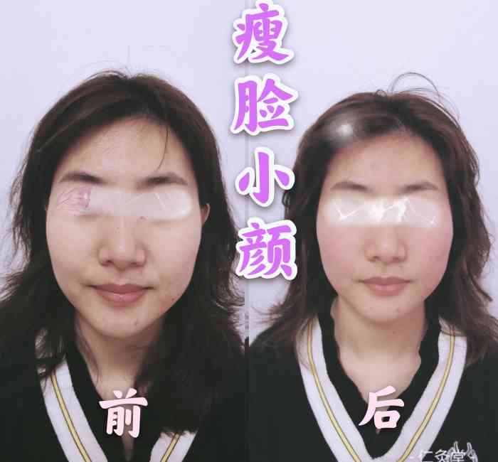 仁灸堂徒手瘦脸小颜-"实事求是的评价,希望能帮助到大家.地点.