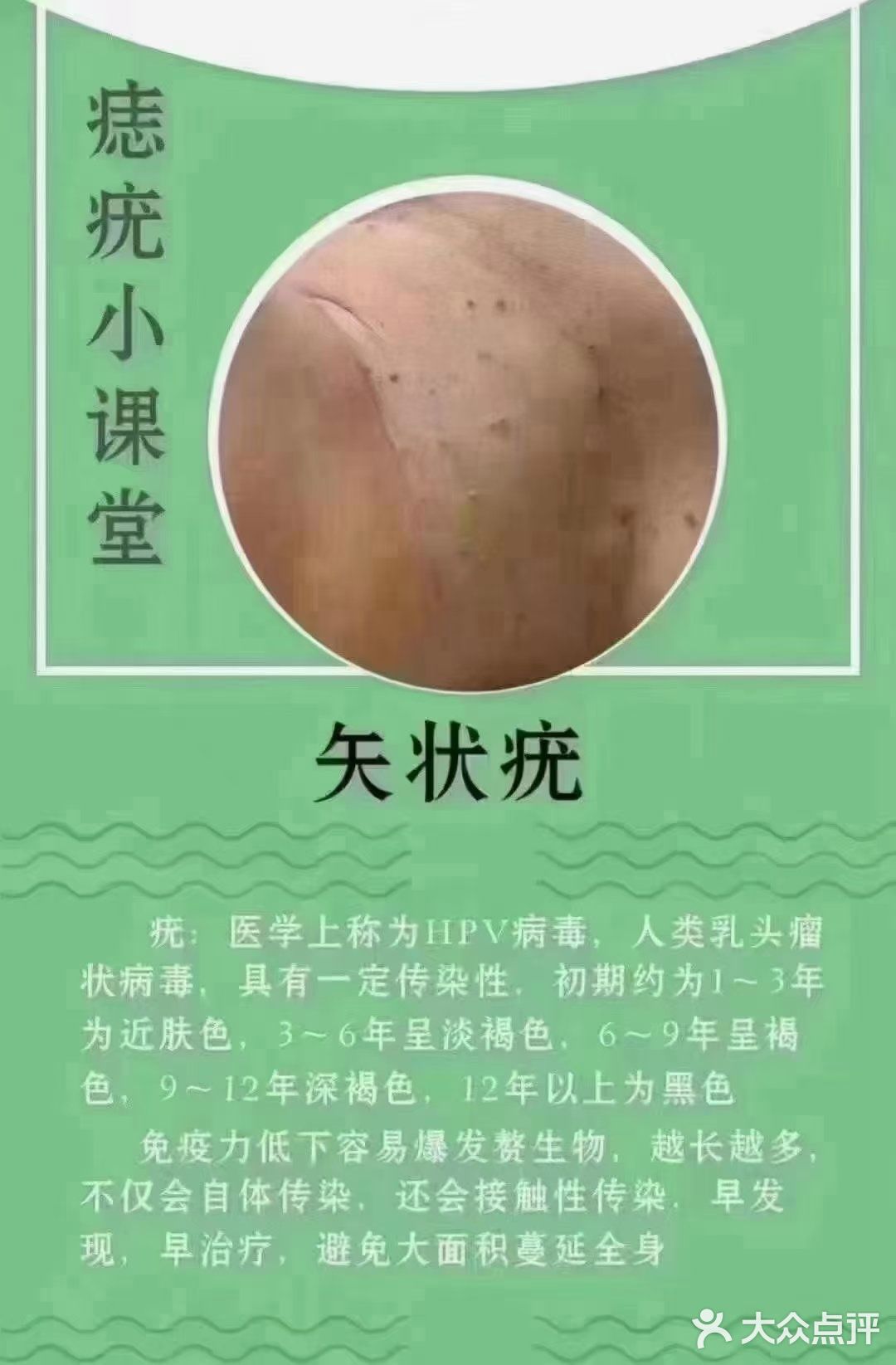 痣疣小课堂你是属于那种