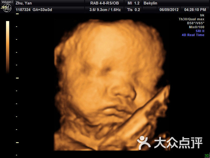 美国贝客四维胎儿摄影33周1187324_011图片-北京孕妇