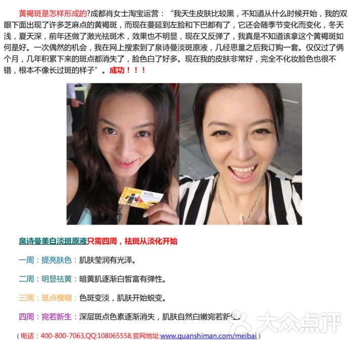 生完孩子脸上有黄褐斑怎么回事-dp97315284的