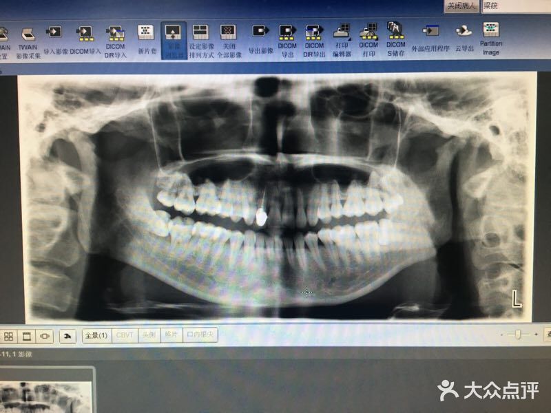 谭建芳口腔连锁x光片图片