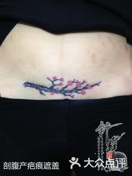纹身光谷步行街纹身针锋刺青梅盖剖腹产疤痕