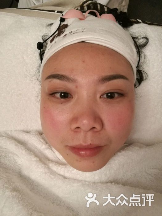 艾木槿花美肤管理中心(后湖店)-激光爆破后炭粉