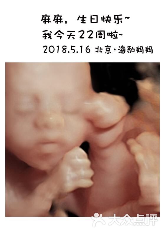 海豹妈妈四维彩超五维彩超图片-北京孕妇写真-大众