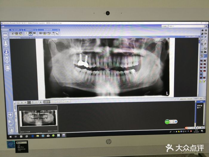 皓尔国际口腔(燕莎佳亿店)ct全景牙齿片图片 - 第130张