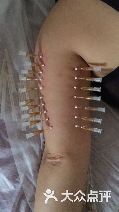 美人草针灸埋线减肥养生馆图片 - 第3张