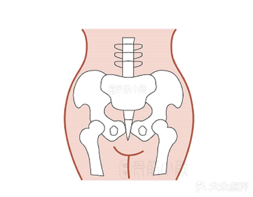 这种情况也需要做骨盆和体态的矫正了