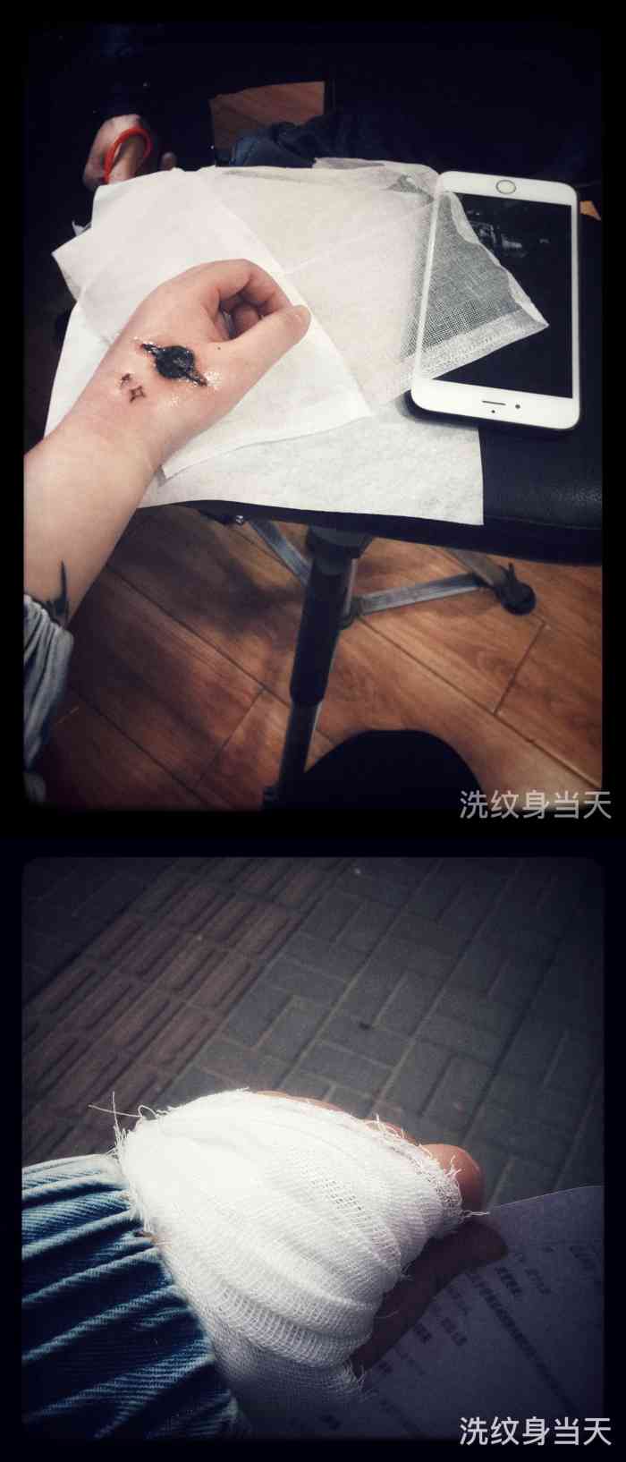 杰刺青一次性洗纹身修复疤痕(超皮秒)-"抽到大众点评