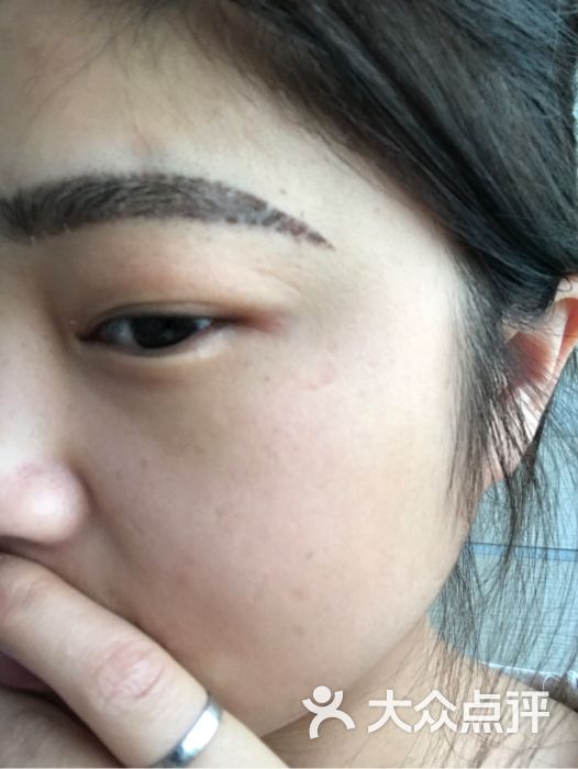 结痂的眉毛 基本没有掉色 只不过我的皮肤是敏感性肌肤 纹完有些发红