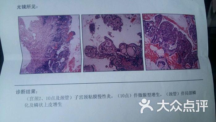 杭州艾玛妇产医院-这张是活检报告图片-杭州-大众点评网