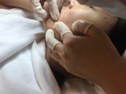 粉刺清理全程 vlkUucGujqia0UYDLWe5S-qVyJFrUonRoEUhaObWD87oiKvOVDP-pDzzWKQyh66O.jpg