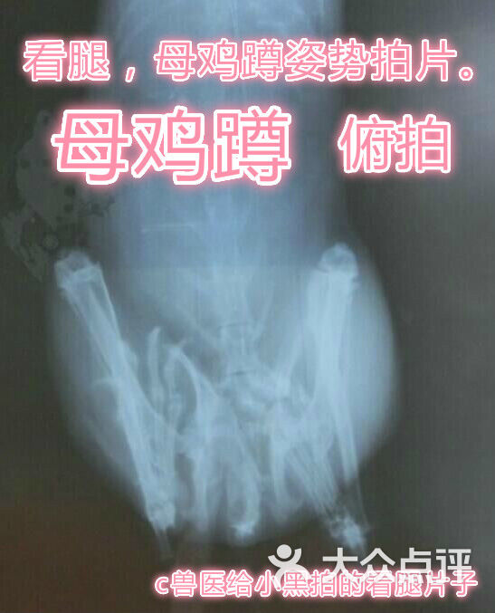 医院拍的看腿的x光图片