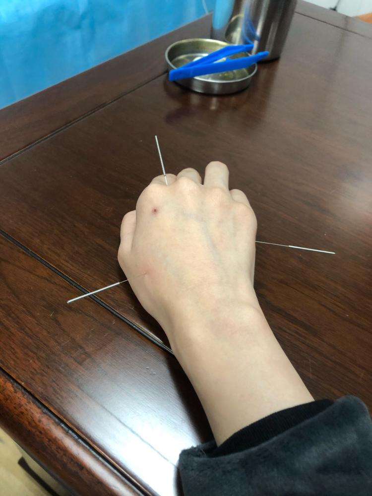 上海三针堂中医门诊部-"第一次对中医的针灸有了敬畏之心!来上海.