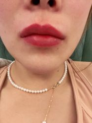 体验后-天津伊美尔医疗整形美容专科医院