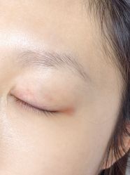 -德绣·机器野生眉发际线·美瞳线半永久