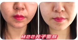 -兰州华美整形美容医院