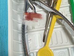 -上海仁爱医院口腔科 · 种植