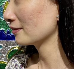 体验前-上海玫瑰医疗美容医院