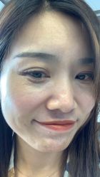 -小忠丽格医美