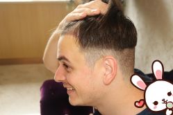 点击看大图 -大麦微针植发丨全国连锁