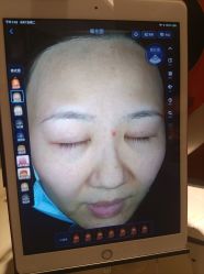 -洁铭新加坡医美